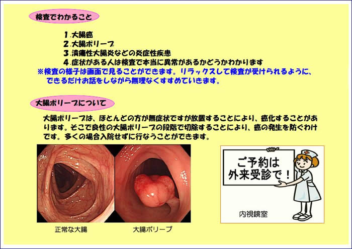 ファイバー 検査 大腸
